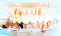 镶牙和补牙的区别