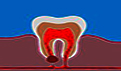 老年人牙齿缺失有哪些危害？牙齿缺失怎么办