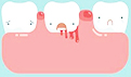 牙齿出血是什么原因？六大原因要注意