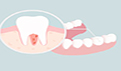 人有几种牙齿类型？怎么保护牙齿