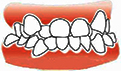 常见遗传性牙齿畸形的表现 孩子牙齿畸形原因