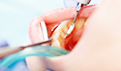 牙齿松动有什么办法处理？
