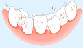 骨性龅牙是怎么形成的？有哪些危害